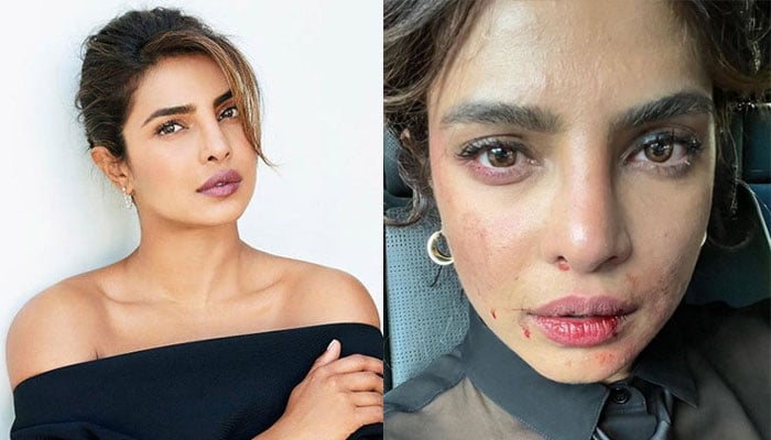 Priyanka Chopra leaves fans concerned as she drops picture with blood marks on her face