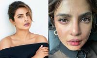Priyanka Chopra Leaves Fans Concerned As She Drops Picture With Blood Marks On Her Face