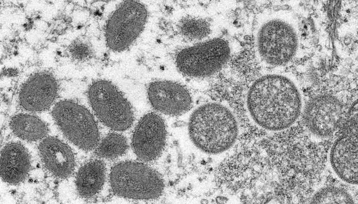 Canada reports 10 more cases of monkeypox in Quebec. Photo: AFP