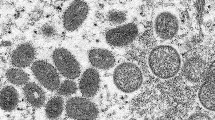 Canada says 15 cases of monkeypox in Quebec, more expected