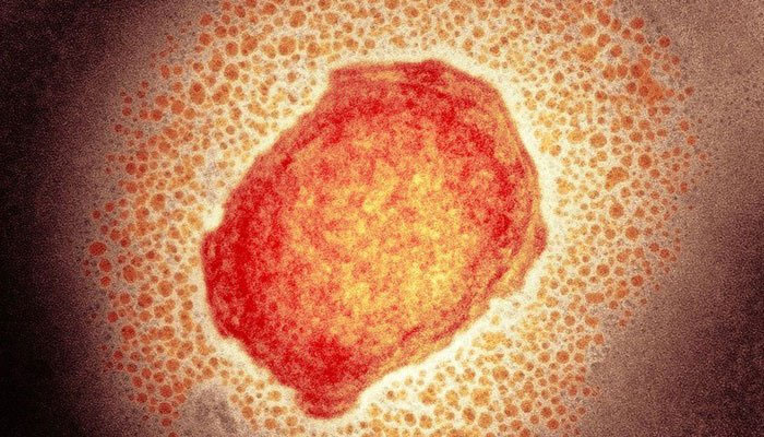 Monkeypox virus particle. Photo: Science Photo Library