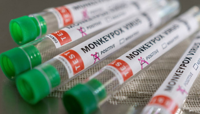 Test tubes marked as positive for the Monkeypox virus are seen in this photo illustration taken on May 22, 2022. Photo: Agencies