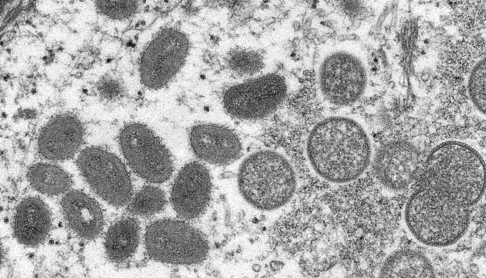 Gambar selebaran mikroskopis elektron (EM) tak bertanggal yang disediakan oleh Pusat Pengendalian dan Pencegahan Penyakit ini menggambarkan virus cacar monyet yang diperoleh dari sampel klinis.  foto: AFP