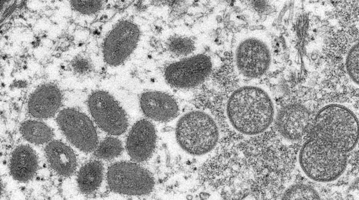 US health experts say monkeypox cases harder to detect