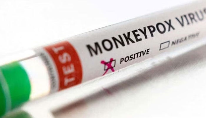 WHO calls for urgent action in Europe over monkeypox. Photo: The News/File