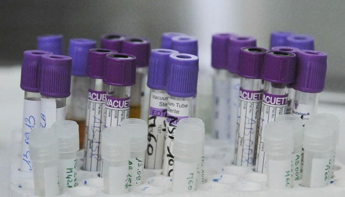Blood samples taken in 2013 as part of a Unitaid-funded project to better survey people living with HIV in Abidjan, Ivory Coast. Photo:  AFP/File