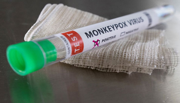 Spain reports first monkeypox-related death: ministry
