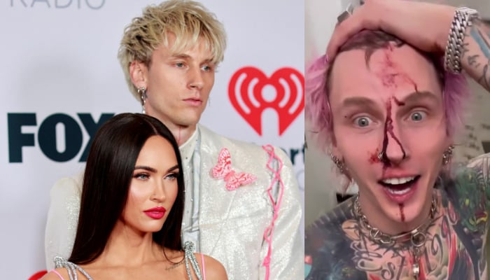 Machine Gun Kelly bloodied himself at a recent show amid rumours of him and Megan Fox splitting