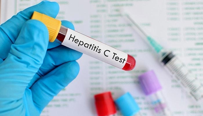A representational image of a blood sample for testing of hepatitis C virus. — AFP/File