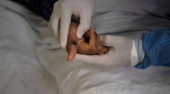 Egypt records its first monkeypox case