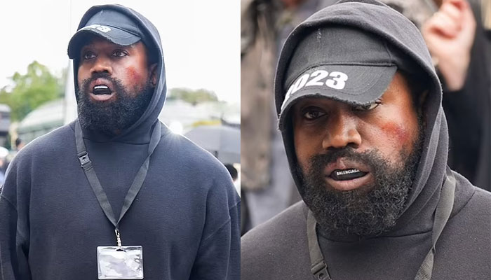Kanye West leaves fans stunned with bruised appearance during Paris Fashion Week