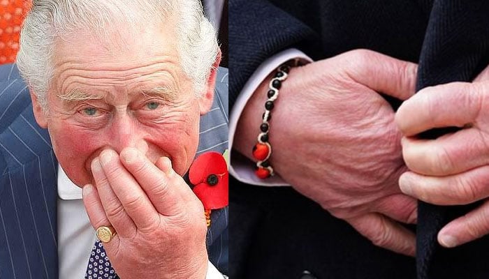 King Charles swollen fingers spark health concerns amid royal duties