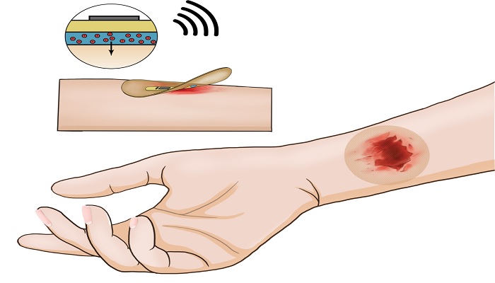 Illustrazione di un bendaggio intelligente wireless sul braccio umano. — Jian-Cheng Lai, Bao Research Group, Stanford University
