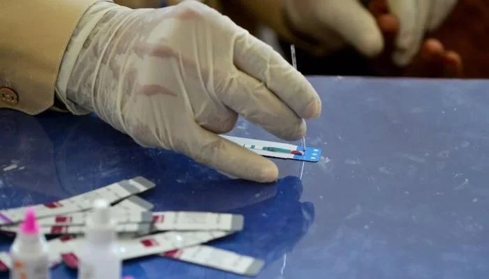 In questa immagine scattata l'8 maggio 2019, un medico pakistano esamina il campione di sangue di un paziente per un test HIV in un ospedale statale.  - AFP