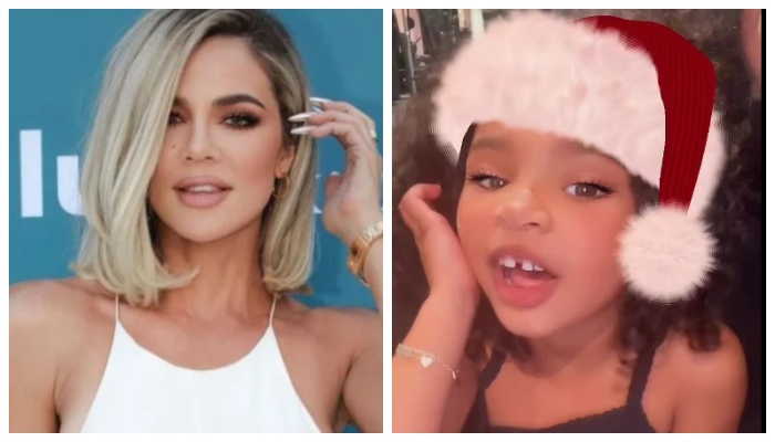Khloe Kardashian’s daughter looks adorable with her first broken tooth