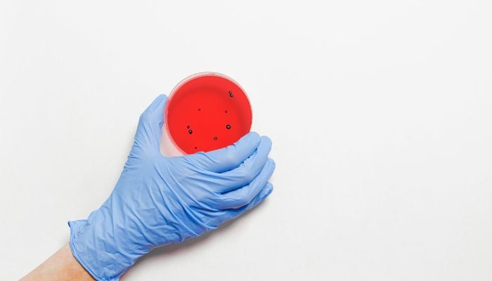 Una persona che indossa guanti e tiene in mano una capsula di Petri.— Pexels