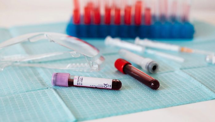 Full vials of blood near various medical equipment for taking blood.— Pexels