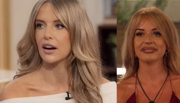 Love Island star Faye Winter says her parents thought her lip fillers made her look silly on the show