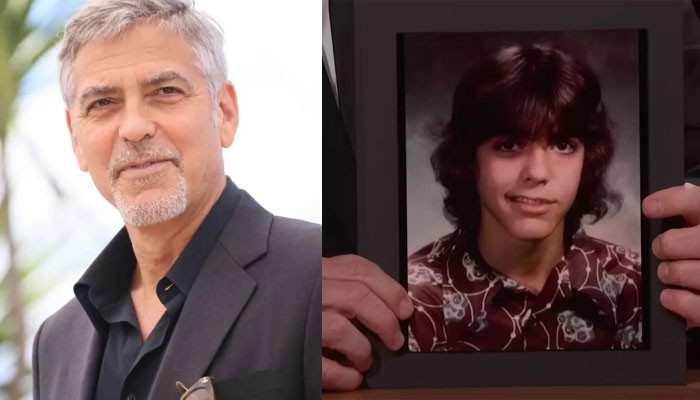 George Clooney mengatakan dia menderita Bell’s Palsy saat remaja