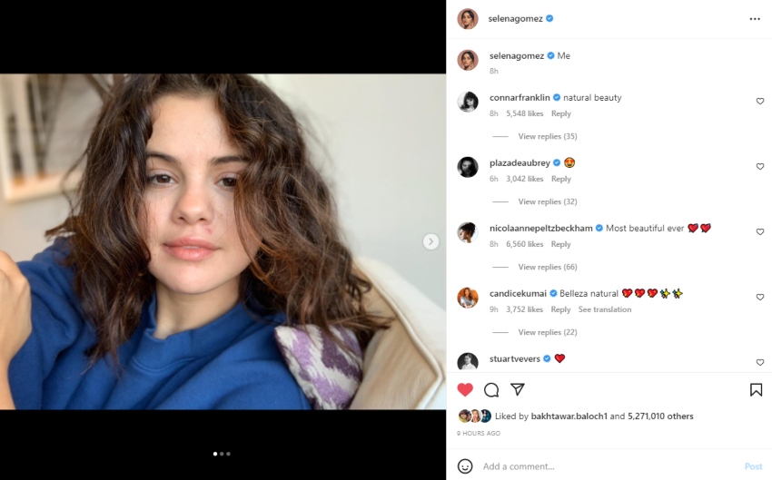Selena Gomez posts makeup-free selfies, Nicola Peltz calls her most beautiful ever