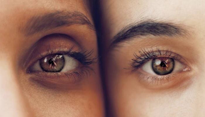 Image shows close-up photography of eyes.— Unsplash