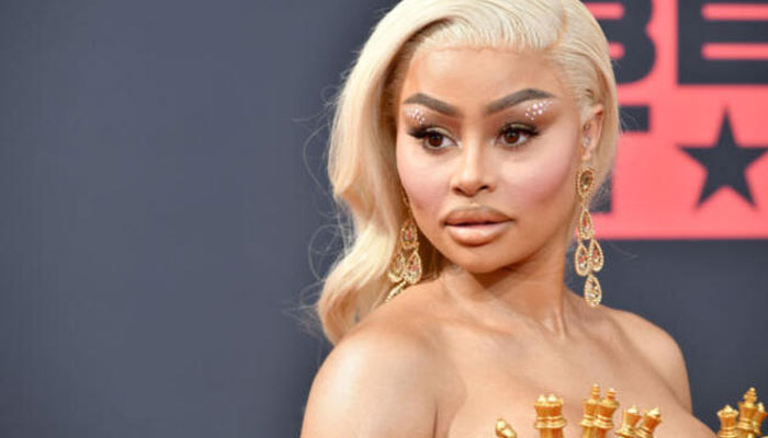 Blac Chyna gets facial fillers removed for ‘looing like a jigsaw puzzle’