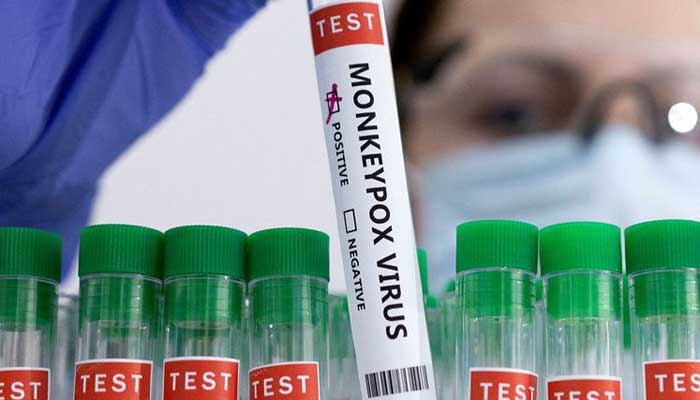 A photograph of a positive monkeypox virus sample. — AFP/File