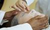 'New wound dressings could help burn injuries heal faster'