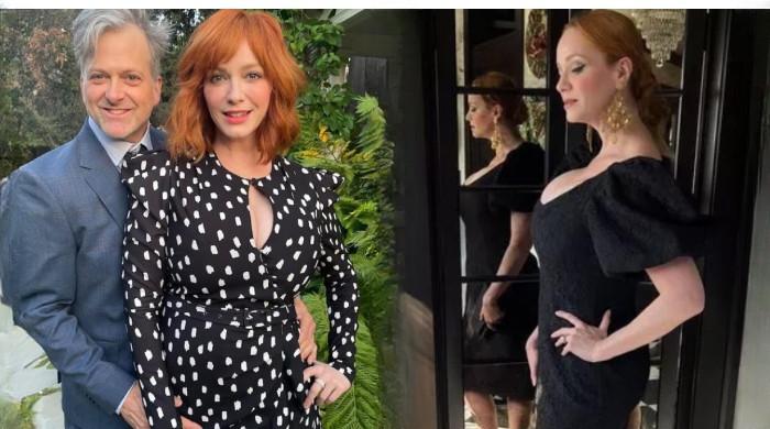 Christina Hendricks Hair Loss