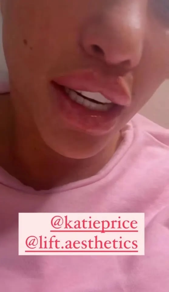 Katie Price takes a daring step in her journey to ‘start fresh’