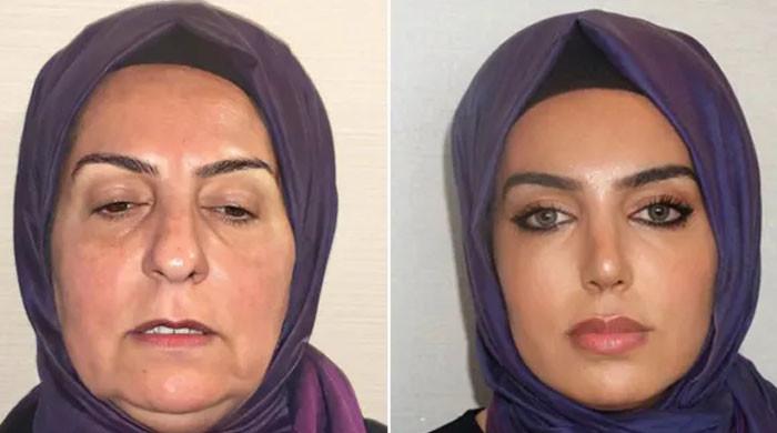 68 yaşındaki Türk bayanı güzel duyu operasyonlar sonrası tanınmaz hale geldi – İnternet bununla yüzleşemiyor