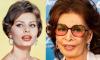 Sophia Loren recovering from emergency surgery after fall
