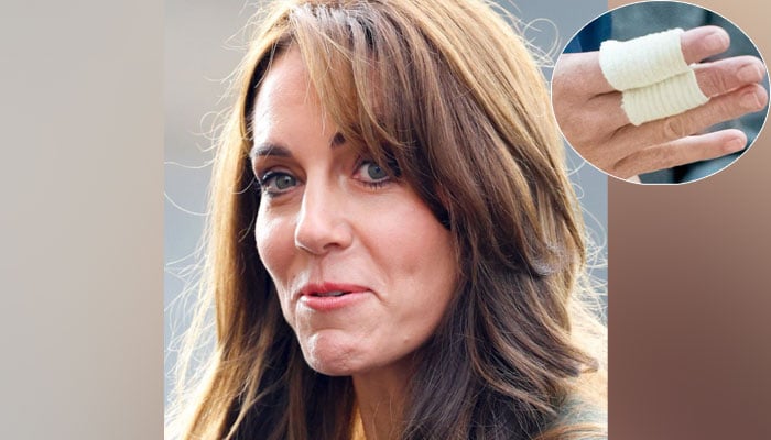 Kate Middletons frail health has caused royal watchers to be concerned