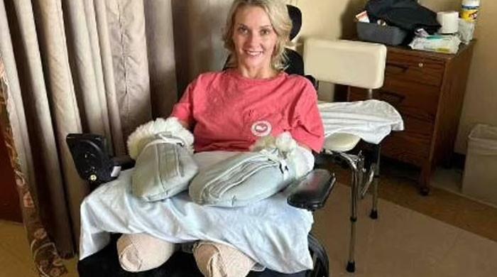 Woman loses all four limbs as she goes through kidney stone surgery