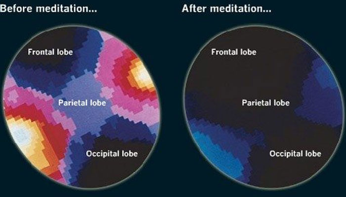 چارٹ دکھا رہا ہے کہ مراقبہ سے پہلے اور بعد میں آپ کے دماغ میں کیا ہو رہا ہے - بمپر