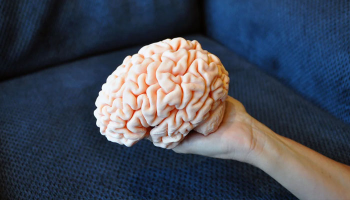 A representational image of a 3-D printed brain. — Reddit/@st314