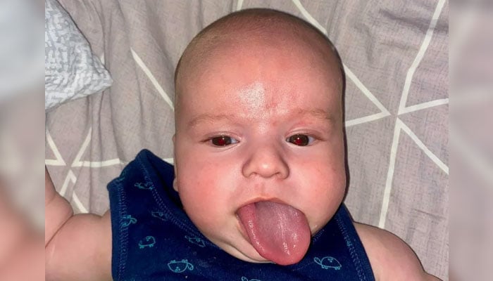 An image of Levchikov with his super tongue sticking out of his mouth. — Newsflash/File