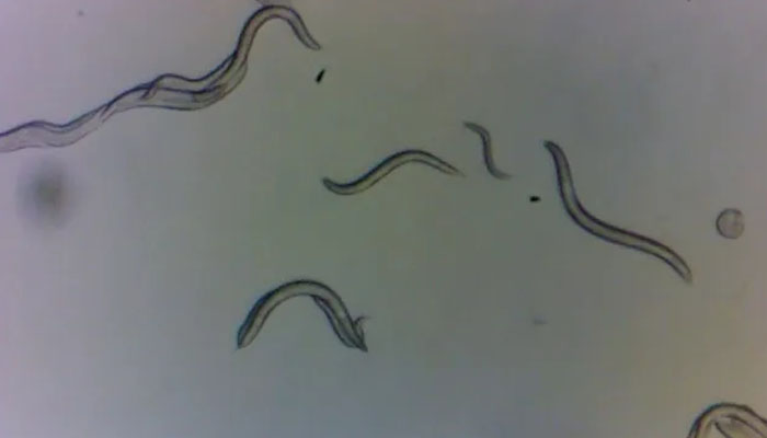 These microscopic worms are resistant to radiation exposure. — Sophia Tintori/File