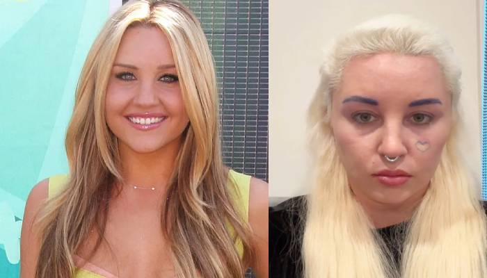 Amanda Bynes opens up about weight gain on social media