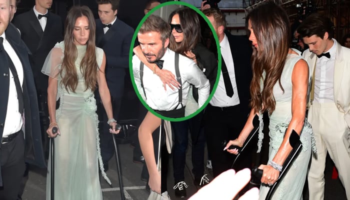 Why did Victoria Beckham attend her birthday party in crutches?