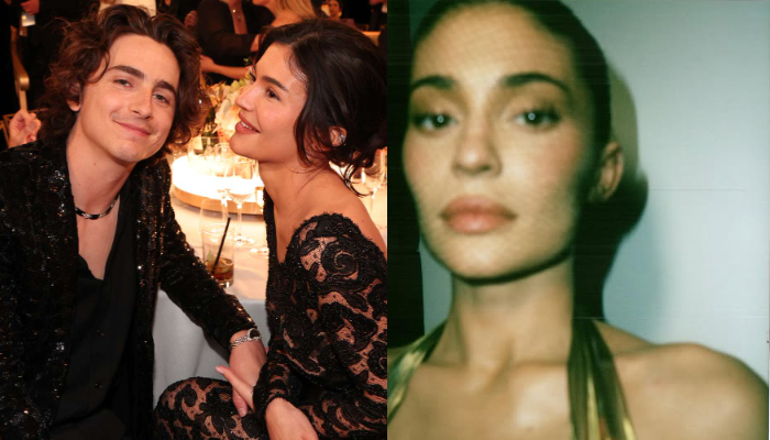 Kylie Jenner gets surgery amid marriage reports with Timothée Chalamet