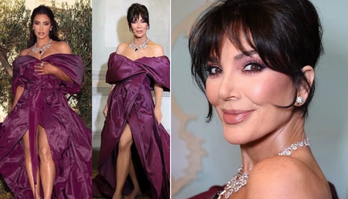 Fans slam Kris Jenners leg leaves fans shocked and confused