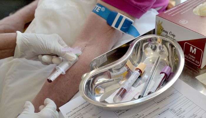 Scientists create first-ever diagnostic blood test in chronic fatigue breakthrough