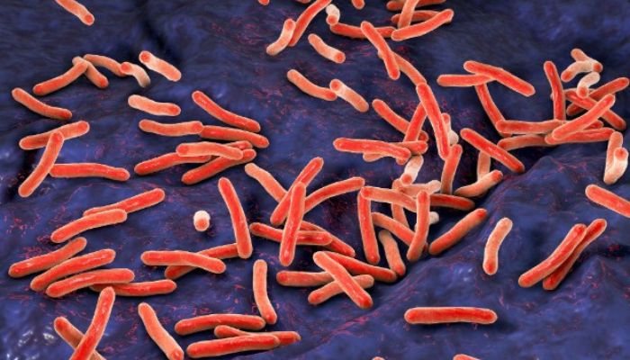Tuberculosis cases are alarmingly rising in Britain, UK Health Security Agency warns