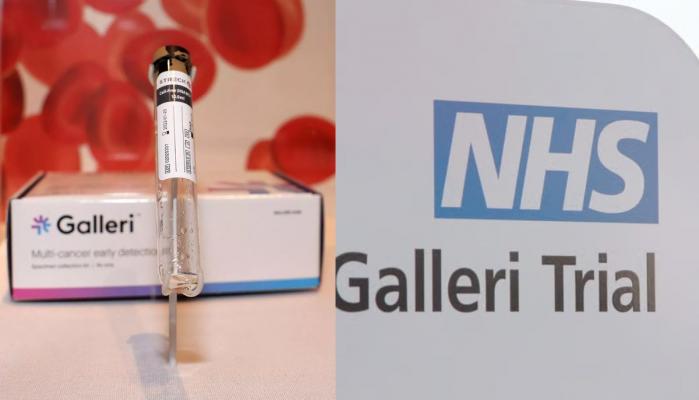 Revolutionary ‘Holy grail’ blood test detects over 50 cancers in early trials