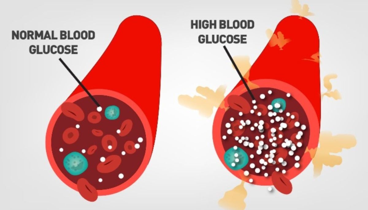 غذا ، نیند اور سرگرمی میں معمولی بہتری جسم کے میٹابولک لچک کو صحت مند گلوکوز ریگولیشن کو بحال کرنے کی اجازت دیتی ہے
