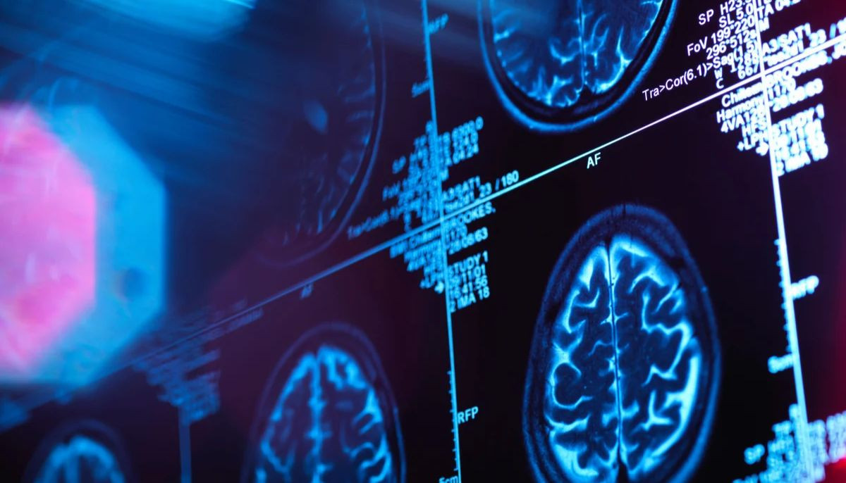 New study maps five brain ‘eras’ showing adulthood not starting until ...