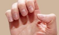 7 nail colour changes doctors say you shouldn’t ignore