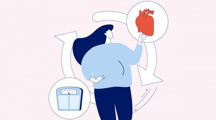 Struggling with obesity? Here's how to manage it