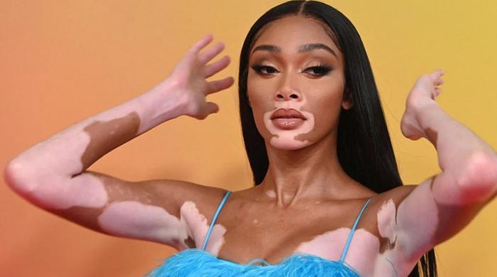 Winnie Harlow breaks vitiligo stereotypes: 'I'm not a sufferer' 